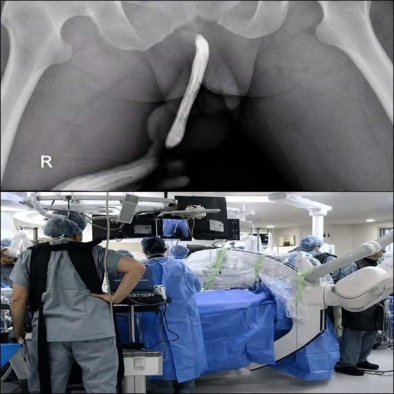 Una joven terminó en el hospital y una radiografía mostró algo inesperado: esto es lo que realmente puede revelar una imagen médica